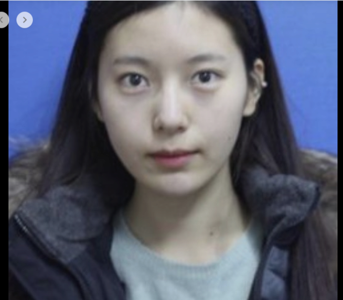 야옹이 작가 성형전 사진